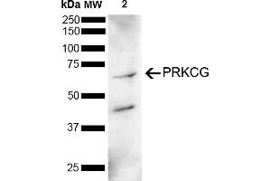Western blot analysis of Mouse Brain showing detection of 78 kDa PRKCG protein using Rabbit Anti-PRKCG Polyclonal Antibody (ABIN5695970).