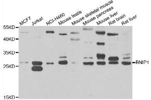 Western blot analysis of extracts of various cell lines, using BNIP1 antibody. (BNIP1 antibody)