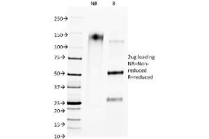 SDS-PAGE Analysis of Purified CTLA4 Mouse Monoclonal Antibody (L4P2F5. (CTLA4 antibody)