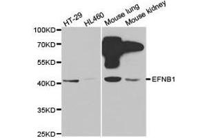 Western Blotting (WB) image for anti-Ephrin B1 (EFNB1) antibody (ABIN1872442)