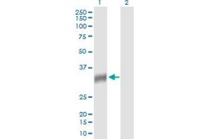 Western Blot analysis of NAT2 expression in transfected 293T cell line by NAT2 MaxPab polyclonal antibody. (NAT2 antibody  (AA 1-290))