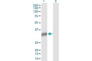 Western Blot analysis of NAT2 expression in transfected 293T cell line by NAT2 MaxPab polyclonal antibody.