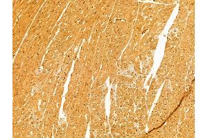 ABIN6263423 and ABIN6273058 at 1/100 staining Rat heart tissue by IHC-P. (MTO1 antibody  (N-Term))