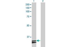 Western Blot analysis of HADH expression in transfected 293T cell line by HADH MaxPab polyclonal antibody. (HADH antibody  (AA 1-314))
