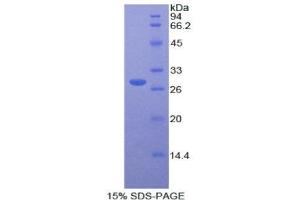 SDS-PAGE (SDS) image for Protease, serine, 8 (PRSS8) (AA 33-218) protein (His tag) (ABIN2121951)