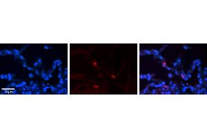 Rabbit Anti-FCGRT Antibody     Formalin Fixed Paraffin Embedded Tissue: Human Lung Tissue  Observed Staining: Membrane and cytoplasmic in alveolar type I cells  Primary Antibody Concentration: 1:100  Other Working Concentrations: 1/600  Secondary Antibody: Donkey anti-Rabbit-Cy3  Secondary Antibody Concentration: 1:200  Magnification: 20X  Exposure Time: 0.