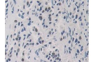 Immunohistochemistry (IHC) image for anti-Heterogeneous Nuclear Ribonucleoprotein A1 (HNRNPA1) (AA 2-372) antibody (ABIN7443554)