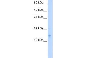 WB Suggested Anti-VAMP5 Antibody Titration:  5. (VAMP5 antibody  (Middle Region))