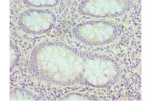 Immunohistochemistry of paraffin-embedded human epityphlon tissue using ABIN7152160 at dilution of 1:100 (EIF3H antibody  (AA 80-340))