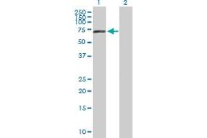 Western Blot analysis of ACSF2 expression in transfected 293T cell line by ACSF2 MaxPab polyclonal antibody. (ACSF2 antibody  (AA 1-615))