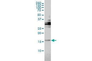 TRAPPC2 monoclonal antibody (M01), clone 2E10 Western Blot analysis of TRAPPC2 expression in Hela . (TRAPPC2 antibody  (AA 1-140))