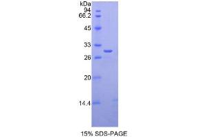 GLI Family Zinc Finger Protein 3 protein