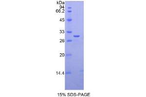 SDS-PAGE analysis of Human GLI3 Protein. (GLI Family Zinc Finger Protein 3 Protein)