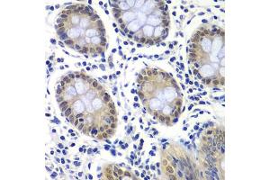 Immunohistochemistry of paraffin-embedded human colon using GTF2F2 antibody (ABIN6131726, ABIN6141494, ABIN6141496 and ABIN6217519) at dilution of 1:200 (40x lens). (GTF2F2 antibody  (AA 1-249))
