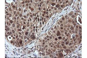 Image no. 8 for anti-Leucine Zipper and CTNNBIP1 Domain Containing (LZIC) antibody (ABIN1499239) (LZIC antibody)