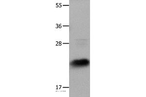 Western blot analysis of Hela cells, using IL18 Polyclonal Antibody at dilution of 1:1350