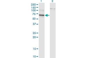Western Blot analysis of TBX22 expression in transfected 293T cell line by TBX22 monoclonal antibody (M01), clone 1A10. (T-Box 22 antibody  (AA 431-519))