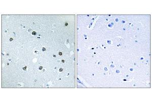 Immunohistochemistry analysis of paraffin-embedded human brain tissue using MYO1D antibody. (Myosin ID antibody  (C-Term))