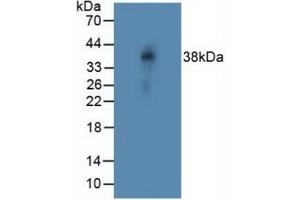 Detection of NOTCH4 in Rat Vein Tissue using Polyclonal Antibody to Notch Homolog 4 (NOTCH4)