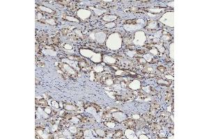 IHC analysis of mSin3A/SIN3A using anti-mSin3A/SIN3A antibody (ABIN7602504). (SIN3A antibody  (AA 8-918))