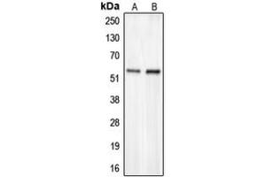 Western blot analysis of CHST2 expression in HepG2 (A), COLO205 (B) whole cell lysates. (CHST2 antibody  (N-Term))