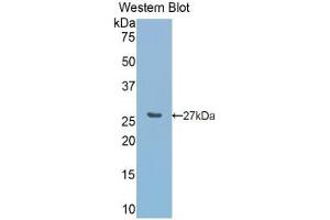 Detection of recombinant CA5A using Polyclonal Antibody to Carbonic Anhydrase VA (CA5A)