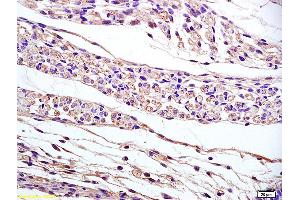 PPAP2B antibody  (AA 241-311)