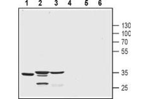 Western blot analysis of human T-cell lymphoma Jurkat cell lysates (lanes 1 and 4), mouse heart lysates (lanes 2 and 5) and rat brain lysates (lanes 3 and 6):1-3.