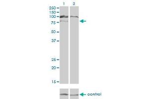 Western blot analysis of HGS over-expressed 293 cell line, cotransfected with HGS Validated Chimera RNAi (Lane 2) or non-transfected control (Lane 1). (HGS antibody  (AA 513-612))