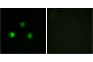 Immunofluorescence analysis of HuvEc cells, using MSH2 Antibody. (MSH2 antibody  (AA 541-590))