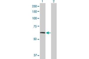 Western Blot analysis of FGFR1 expression in transfected 293T cell line by FGFR1 MaxPab polyclonal antibody. (FGFR1 antibody  (AA 1-731))