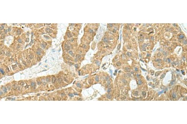 FAM46C antibody