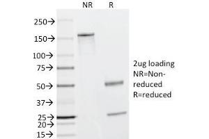 SDS-PAGE Analysis Purified Caldesmon Mouse Monoclonal Antibody (h-CALD). (Caldesmon antibody)