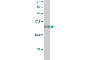 Western Blot detection against Immunogen (37. (VAV1 antibody  (AA 681-790))