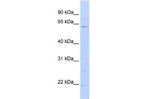 WB Suggested Anti-ZNF680 Antibody Titration:  0.