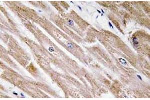 Immunohistochemistry analysis of BMP-5 Antibody in paraffin-embedded human heart tissue. (BMP5 antibody)