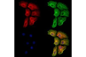 ABIN6264651 and ABIN6273154 staining Hela cells by IF/ICC. (RASGRP3 antibody  (Internal Region))