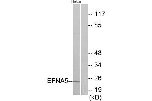 Immunohistochemistry analysis of paraffin-embedded human brain tissue using EFNA5 antibody.