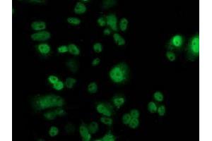 Immunofluorescence (IF) image for anti-Tumor Protein P53 (TP53) antibody (ABIN1499968) (p53 antibody)