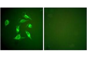 Immunofluorescence analysis of HeLa cells, using PDGFR alpha Antibody.