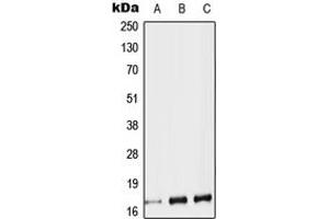 Western blot analysis of Protachykinin 1 expression in HEK293T (A), SP2/0 (B), H9C2 (C) whole cell lysates.