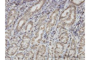 Immunoperoxidase of monoclonal antibody to PNMA1 on formalin-fixed paraffin-embedded human stomach. (PNMA1 antibody  (AA 62-160))