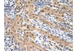 Image no. 1 for anti-Eukaryotic Translation Initiation Factor 3, Subunit M (EIF3M) (N-Term) antibody (ABIN321428) (Eukaryotic Translation Initiation Factor 3, Subunit M (EIF3M) (N-Term) antibody)