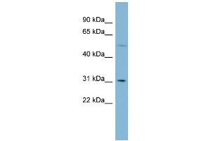 WB Suggested Anti-MRPL28 Antibody Titration: 0. (MRPL28 antibody  (Middle Region))