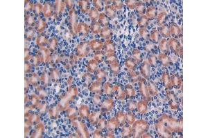 Used in DAB staining on fromalin fixed paraffin-embedded Liver tissue (Galanin antibody  (AA 36-123))