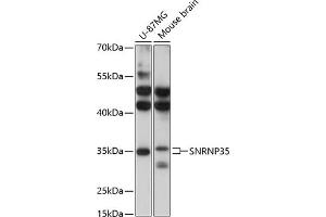 Western blot analysis of extracts of various cell lines, using SNRNP35 antibody (ABIN6132757, ABIN6148206, ABIN6148207 and ABIN6217126) at 1:3000 dilution.