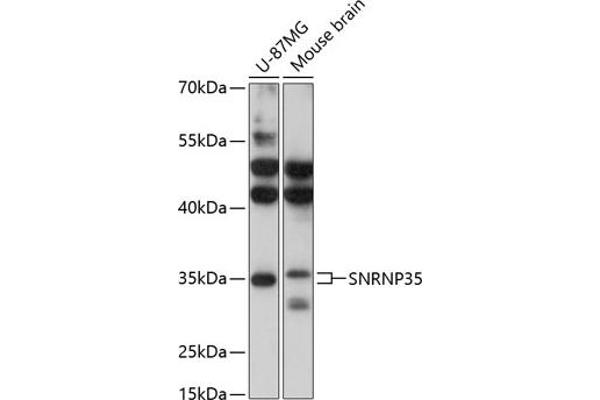 SNRNP35 Antikörper  (AA 1-150)