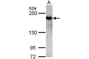 WB Image Sample (30 ug of whole cell lysate) A: Jurkat 5% SDS PAGE antibody diluted at 1:3000 (TOP2B antibody  (C-Term))