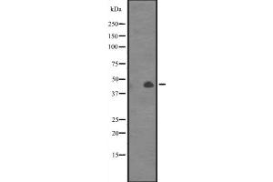 Western blot analysis of CANT1 expression in Jurkat cell line lysates,The lane on the left is treated with the antigen-specific peptide. (CANT1 antibody  (Internal Region))