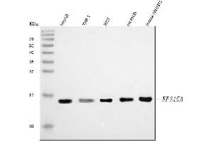 Western blot analysis of RPS15A using anti-RPS15A antibody (ABIN7598954). (RPS15A antibody  (AA 1-113))